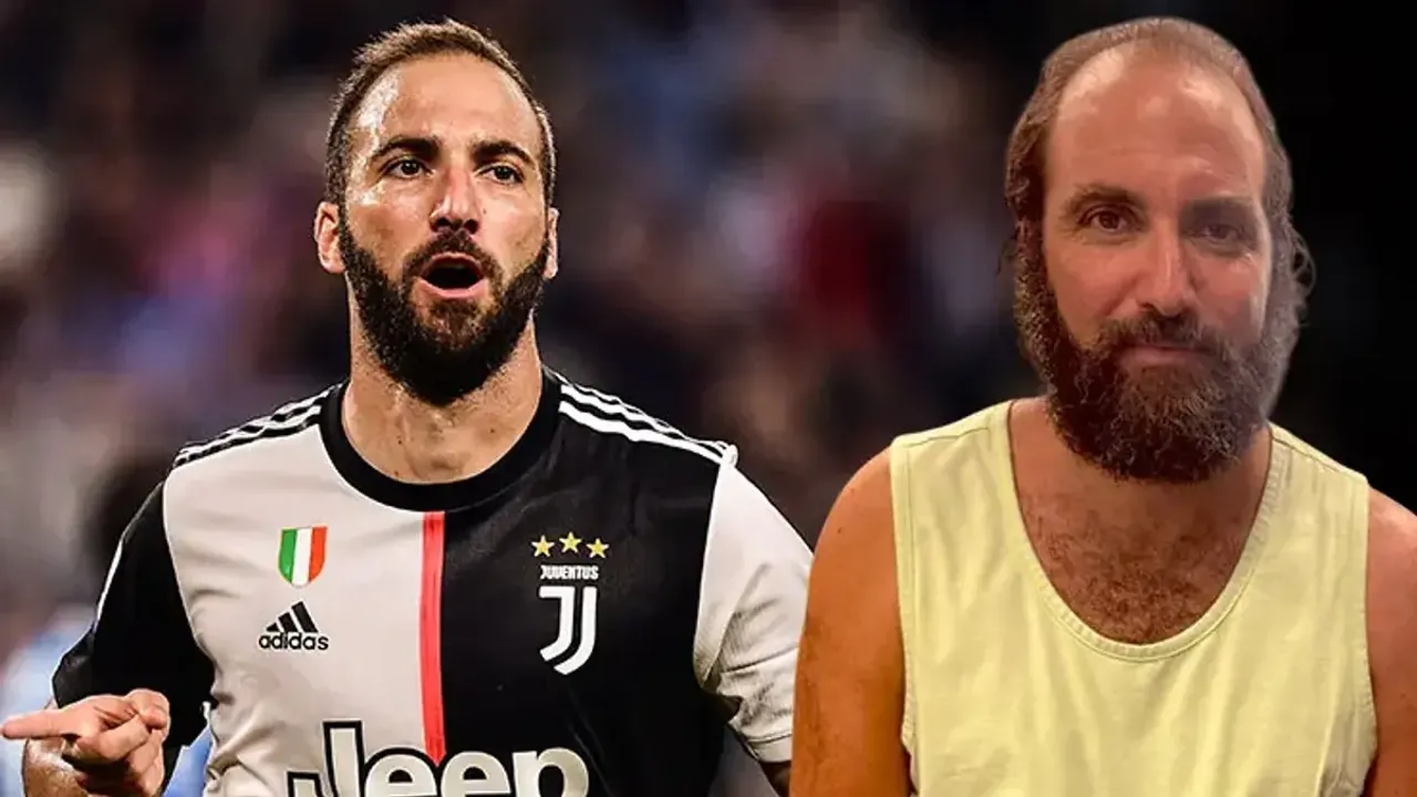 Efsane Golcü Gonzalo Higuain'in Gündem Yaratan Değişimi