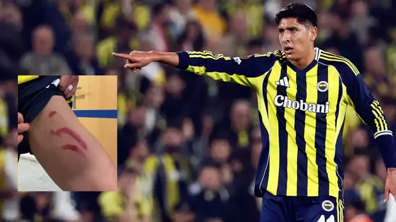 Fenerbahçe'de Edson Alvarez Sakatlığında Son Durum: Yıldız Oyuncudan Sevindiren Haber!